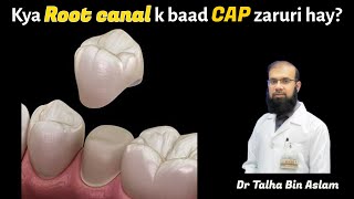 Tooth capDental crown after Root canal treatment or RCT Is it important by Dr Talha Bin Aslam [upl. by Merissa]