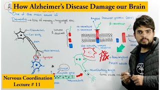 Alzheimers Disease [upl. by Feucht]