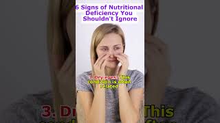 6 Signs of Nutritional Deficiency You Shouldnt Ignore HealthTips Nutrition healthyliving [upl. by Llenrod]