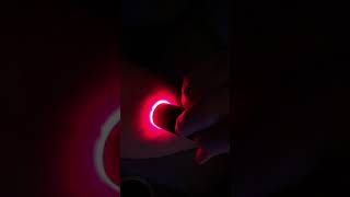 Illumivein Vein Finder In Use  Demonstration Video [upl. by Eednil]