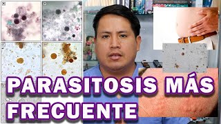 CÓMO ELIMINAR EL BLASTOCYSTIS HOMINIS  UN PARÁSITO MUY FRECUENTE [upl. by Aivil]