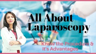 All About Laparoscopy  Know why is it Done  How is it done  By DrNisha Aggarwal [upl. by Manuela]