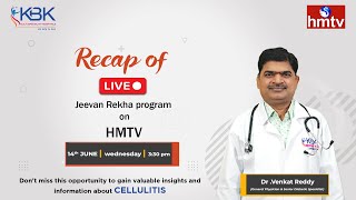 Cellulitis Causes Symptoms Diagnosis and Treatment Explained by Dr Venkat Reddy  KBK Hospitals [upl. by Barnard]