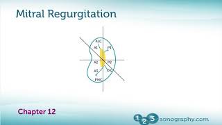 Mitral Regurgitation Echocardiography Basic and Principle [upl. by Hartzell]