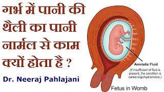 गर्भ में पानी का नार्मल से कम होना और इलाज  Oligohydramnios Causes And Treatment [upl. by Supple]