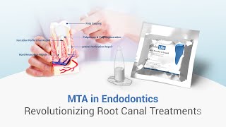 ROLE OF MTA IN ENDODONTICS dental dentalkart waldentMTA EndolifeMTA [upl. by Attenauqa12]