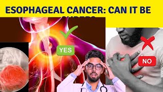 What is the survival rate for esophageal cancer [upl. by Jaban]