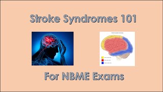 Stroke Syndrome Review 101 for NBME exams [upl. by Inga610]