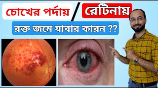 Dysentary absolute solution  Homeopathic treatment for dysentary  home remedies in bengali  Amasa [upl. by Yerggoeg34]