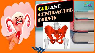 Cephalo Pelvic Disproportion and Contracted Pelvis  Full Explanation in Hindi  By NG Medicals [upl. by Sinegold]