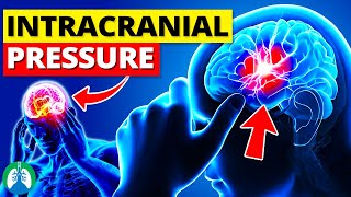 Intracranial Pressure ICP  Quick Explainer Video [upl. by Retnuh]