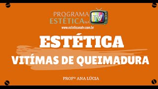 TRATAMENTO ESTETICO PARA TRATAR CICATRIZES DE QUEIMADURAS [upl. by Botnick]