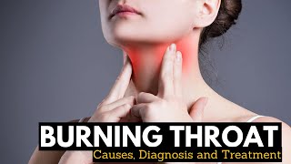 What Causes Burning Throat and its Treatment [upl. by Hahseram323]