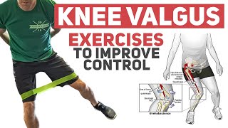 Knee Valgus  Rehab Exercises to Improve Movement Control [upl. by Ailedroc909]