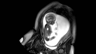 Foetal Development Unborn Baby Movement at 24 Weeks  WIRED [upl. by Schmitz516]