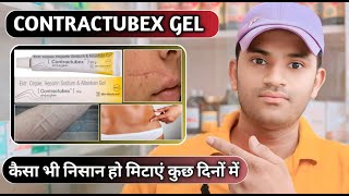 Contractubex gel uses dose benefits and side effects full review in hindi [upl. by Ehpotsirhc]