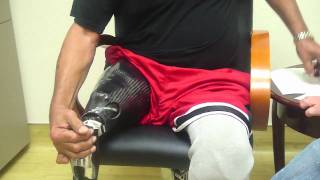 Amputee dons Stan Patterson NPS Elevated Vacuum Above Knee Socket Tutorial [upl. by Balfour]