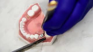 Suturing Around Healing Abutment [upl. by Klayman]