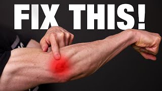 How to Fix Tennis Elbow PERMANENTLY [upl. by Carmela]