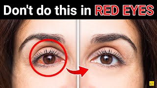 Be Aware of 9 things you should not do in Red Eyes  Credihealth [upl. by Carnahan]