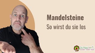 Mandelsteine So wirst du sie los [upl. by Annaillil997]