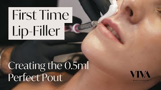 Getting Lip Fillers for the First Time 🧪 Everything You Need to Know about Lip Fillers [upl. by Navonod]