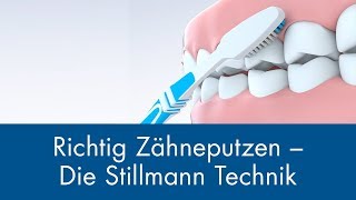 Richtig Zähneputzen  Die Stillmann Technik [upl. by Woermer]