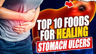 Top 10 Foods to Heal Your Stomach Ulcer Naturally [upl. by Bluefarb426]