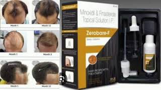 Zerobare F Topical Solution Minoxidil amp Finasteride Topical Solution [upl. by Nerrot]