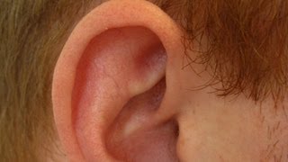 Determine If Ear Cartilage Is Infected  Ear Problems [upl. by Ammej]