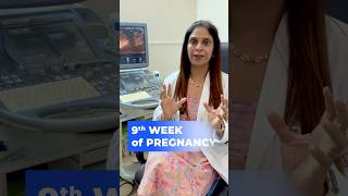 Pregnancy journey9th week प्रेगनेंसी का नौवा हफ़्ताshorts drsoniyagupta weekbyweekpregnancy [upl. by Franciskus961]