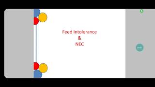 Feed Intolerance amp Necrotising Enterocolitis  A Brief Overview [upl. by Simonne]