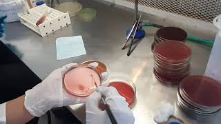 Stool Culture test procedure in Microbiology [upl. by Ries]