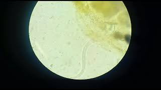 strongyloides stercoralis larvae [upl. by Ettari]