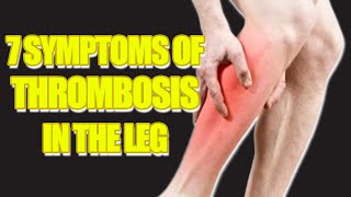 Top 7 Signs and Symptoms of Leg Blood Clots  Preventing Deep Vein Thrombosis [upl. by Nagrom27]