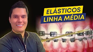 Elásticos de Linha Média  como usar do jeito certo [upl. by Cadmann]