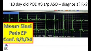 Mount Sinai Pediatric EP Conference 9924 [upl. by Ayatnwahs267]