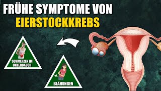 4 Frühe Symptome von Eierstockkrebs auf die du achten solltest [upl. by Mendive]