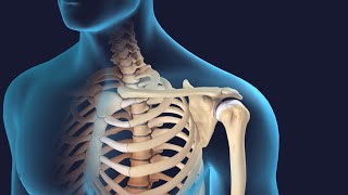 Reverse Shoulder Replacement Surgery [upl. by Rudyard]