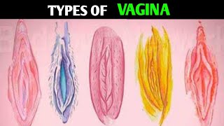 Types Of Vagina  Shapes and Size  Most Attractive Type [upl. by Nedap]