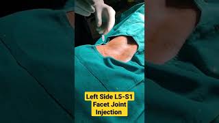 Left Side L5S1 Facet Joint Injection under CArmDr Sai Chandra MBBS DNB Ortho [upl. by Tirzah]