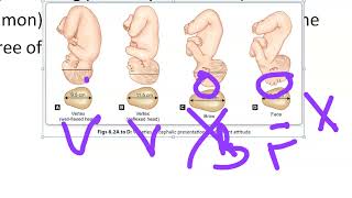 Obsetrics 110 Fetal Presentation Presenting part position difference importance what is [upl. by Seraphine]