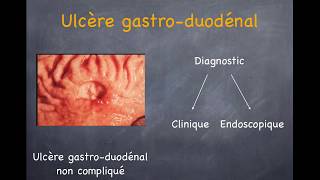 Ulcère gastrique et duodénal Gastrite [upl. by Tugman]