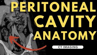 Peritoneal cavity abdominal organs and spaces  Radiology anatomy part 1 prep  CT abdomen [upl. by Acinahs793]