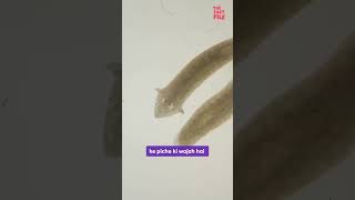 Planaria facts ytshorts worms planaria [upl. by Guillaume]