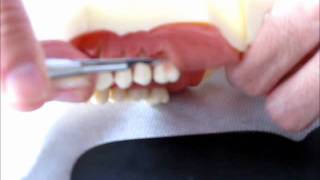 Cirurgia plástica periodontal em modelo Dentart [upl. by Mirna]