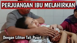 PROSES MELAHIRKAN NORMAL ANAK PERTAMA  DENGAN LILITAN TALI PUSAT [upl. by Herra]