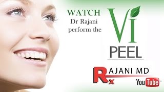 Vi PEEL  Watch it Applied Explained Dr Rajani [upl. by Anirtac]