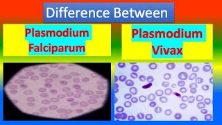 Distinction Between Plasmodium Falciparum and Plasmodium Vivax [upl. by Castora663]