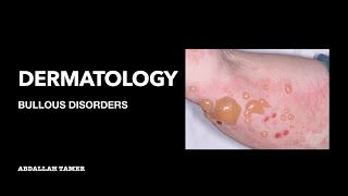 PEMPHIGUS VULGARIS  BULLOUS PEMPHIGOID  بالعربي [upl. by Hairim711]